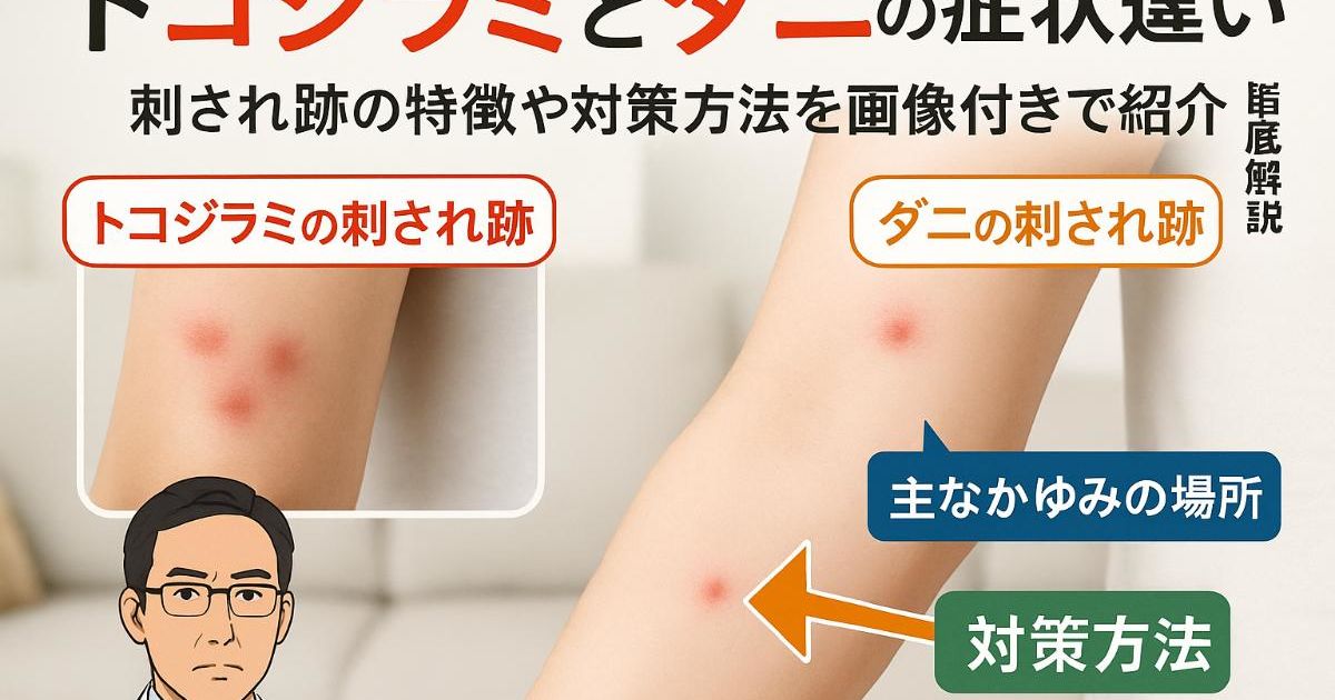 トコジラミとダニの症状違いを徹底解説｜刺され跡の画像や特徴と対策方法
